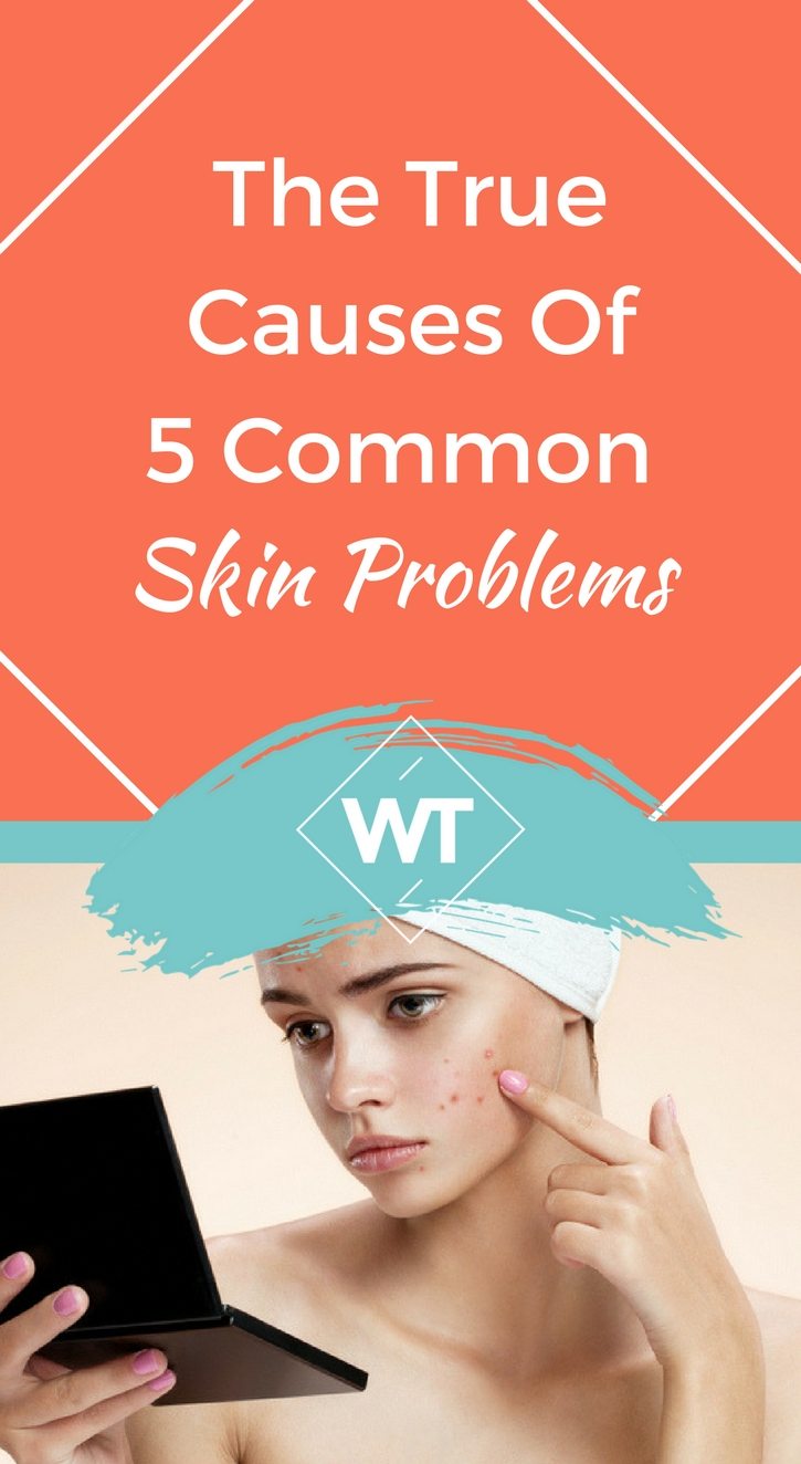 The True Causes Of 5 Common Skin Problems